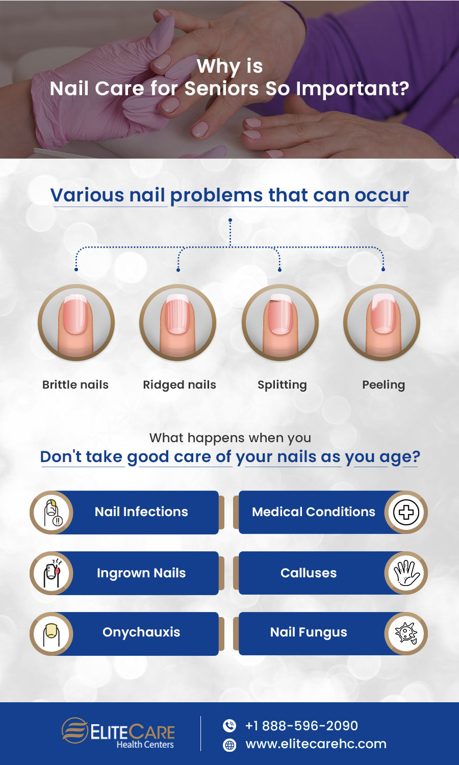 Discover The Importance Of Nail Care For Seniors Elitecare Hc