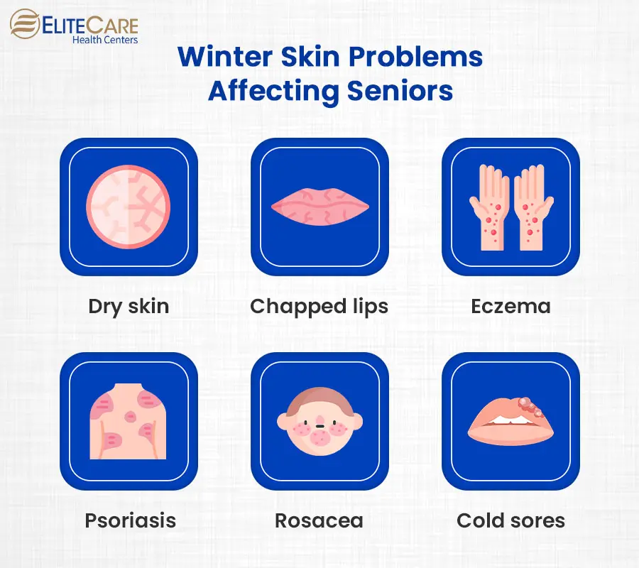 9 Winter Skin Problems & Their Best Solutions + Preventive Tips – SkinKraft