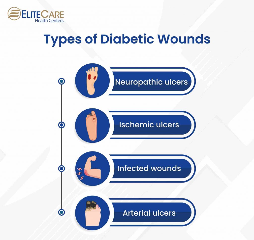 Why Diabetic Wounds Take Longer To Heal In Seniors 