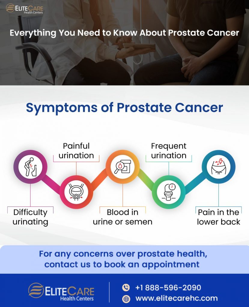 Everything You Need to Know About Prostate Cancer | EliteCare HC